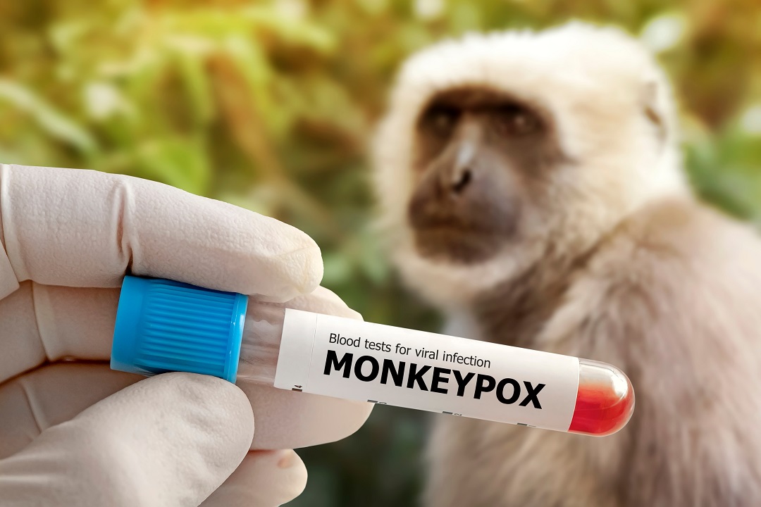 Vaiolo scimmie, dal 1° settembre riprendono prenotazioni vaccini